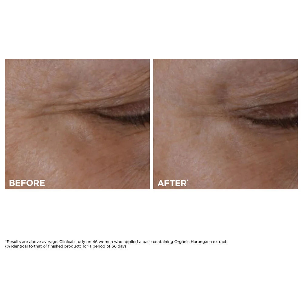 Recharge de Crème Yeux Total Eye Lift pour la Fermeté, les Rides, les Cernes et les Poches
