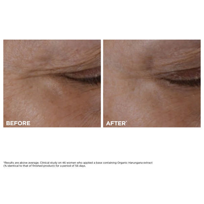 Recharge de Crème Yeux Total Eye Lift pour la Fermeté, les Rides, les Cernes et les Poches